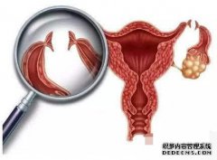结扎对女性有什么伤害？伤害大不大？听