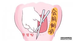 那些经历过“侧切”的女性，后来都怎样