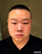 被问“一亩地”多大？岳云鹏脱口而出的