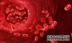 宫颈糜烂、颈动脉斑块、子宫肌瘤…9种病