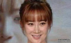 整容整“毁”了的女星: 第一位面部塑料
