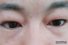 肾脏虚弱的男人，头上3个“丑相”很显眼