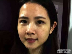 最近有一则报道说是一个女士由于脸色发