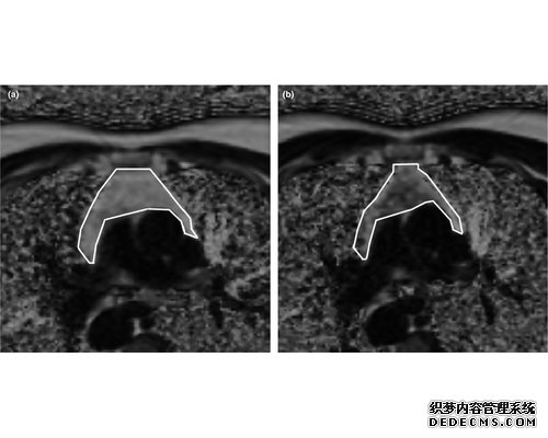两院院士评选2019年中国、世界十大科技进展新闻