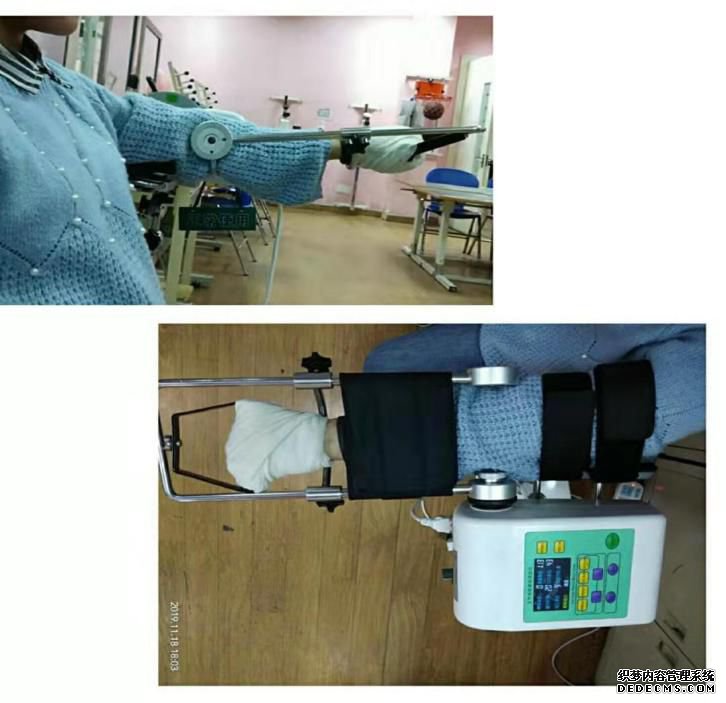通俗易懂，偏瘫患者需要了解的缓解肌张力常用的方法