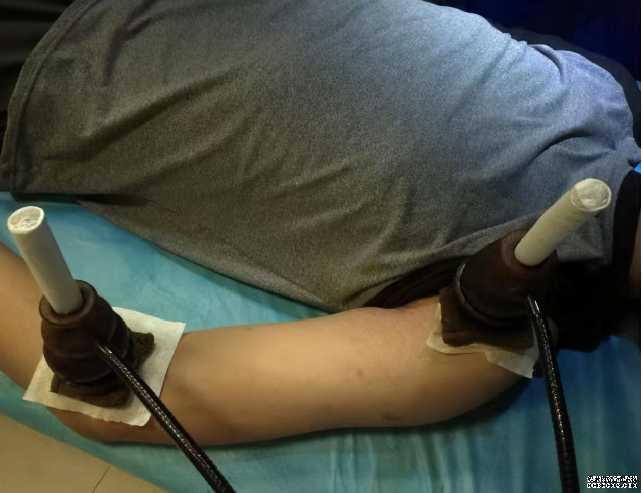 通俗易懂，偏瘫患者需要了解的缓解肌张力常用的方法
