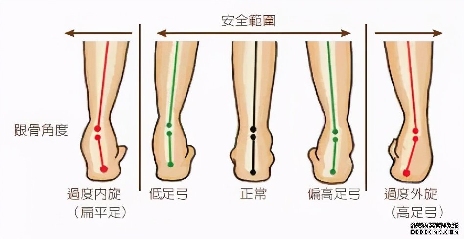 偏瘫患者异常步态的矫正方法，这些你应该知道