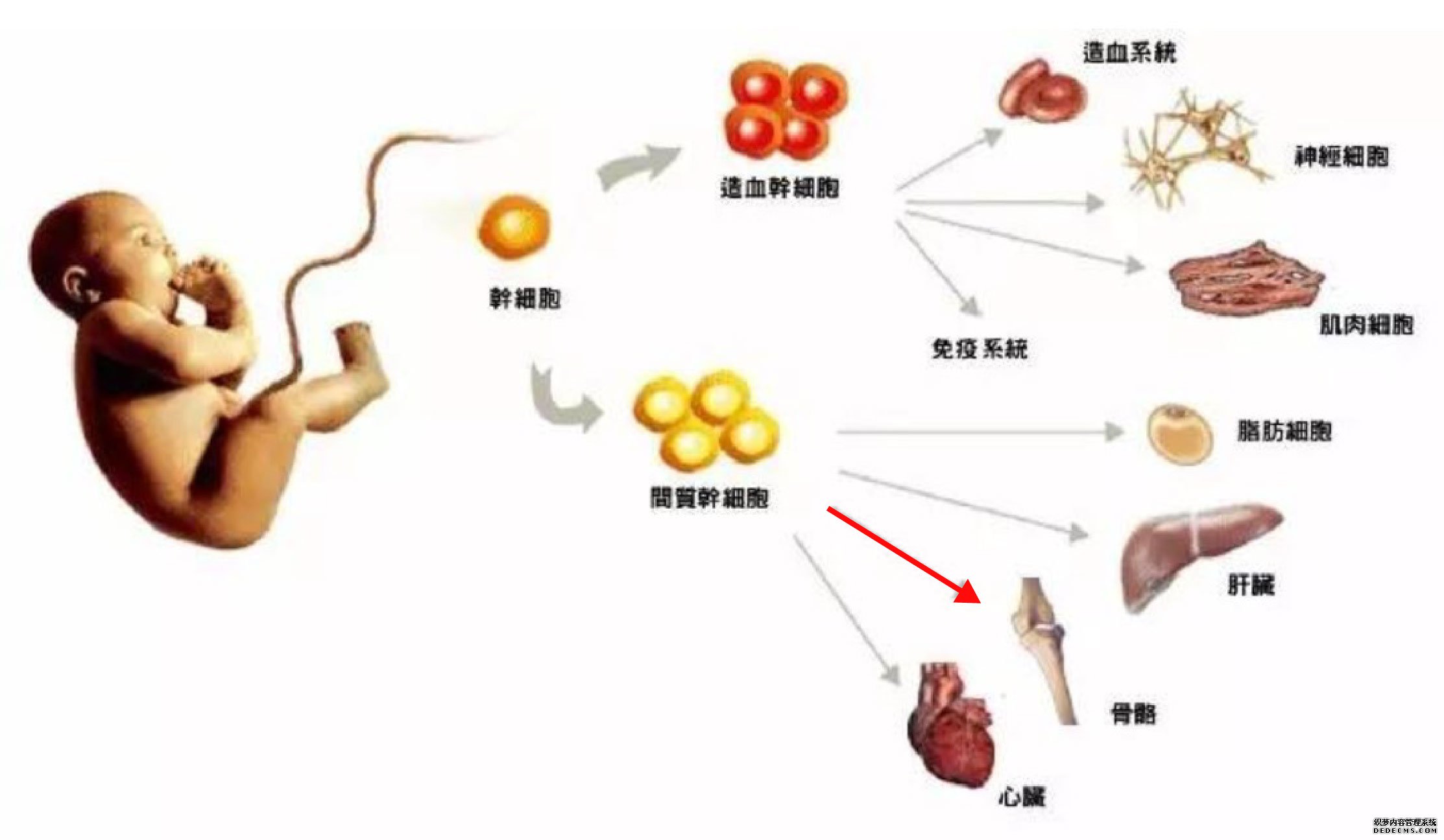 人脐带间充质干细胞可以安全有效的治疗膝关节炎吗？
