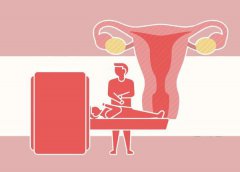 女性多少岁才会进入更年期?若身体出现这