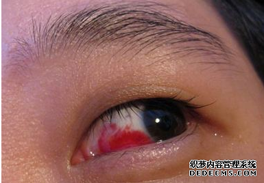 医生提醒：一旦身上有这些症状，多半是肝硬化，为了健康，抓紧查