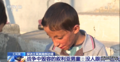 令人心碎！战争中毁容的叙利亚男孩：没