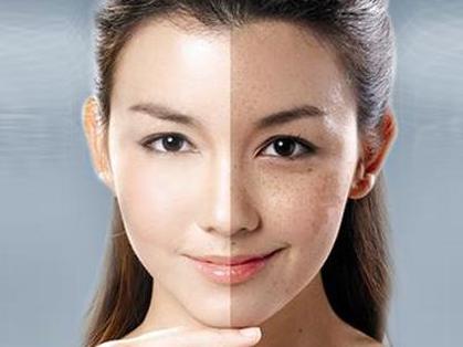 脸上长斑要怎样可以去除脸上的斑点